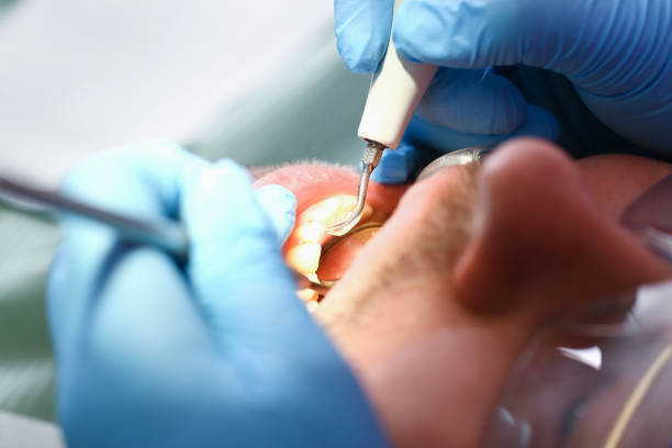 Best Emergency Tooth Extraction in Prairie Du Chien, WI