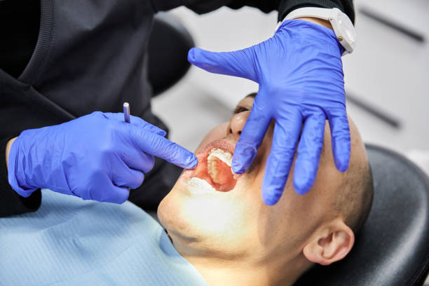 Best Emergency Wisdom Teeth Removal in Prairie Du Chien, WI